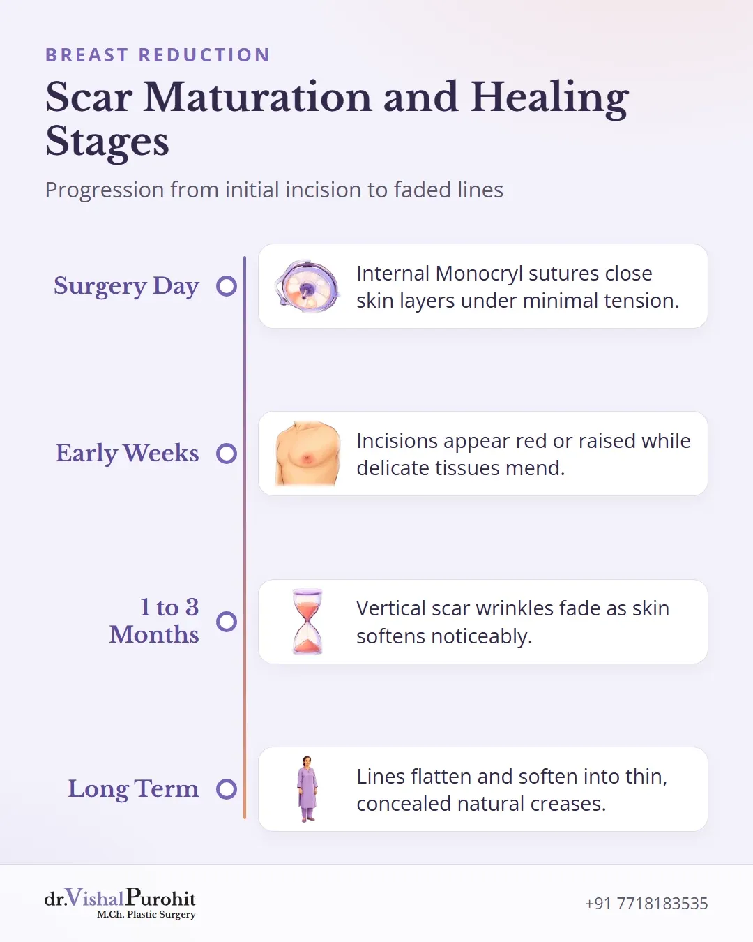 Timeline of breast reduction scar maturation from surgical closure to long-term fading.