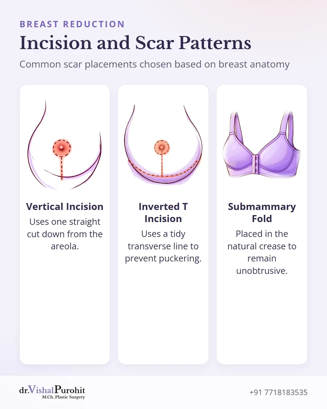 Comparison of vertical, inverted-T, and submammary fold scar placement techniques.