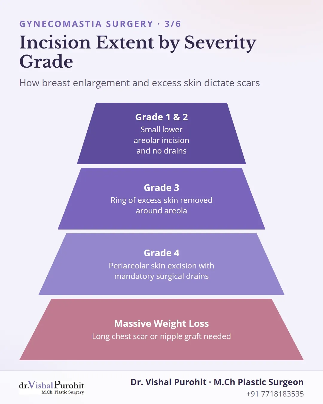 Pyramid chart showing scarring requirements across gynecomastia grades 1 to 4 and massive weight loss.