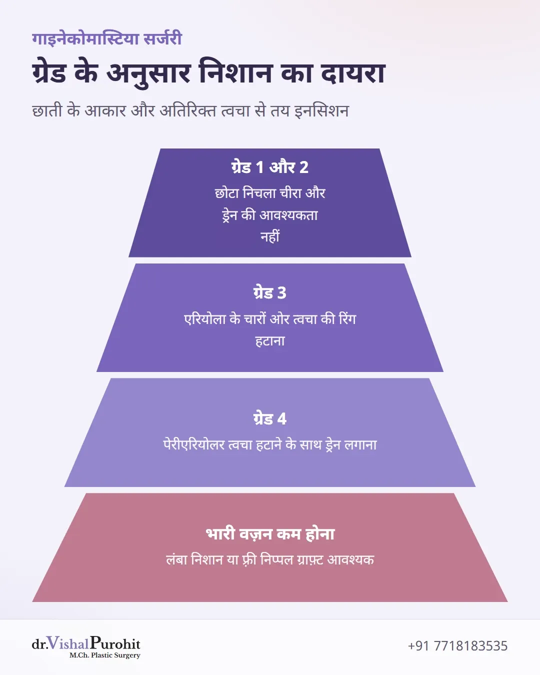 गाइनेकोमास्टिया ग्रेड 1 से 4 और वज़न घटने के बाद आवश्यक निशानों का पिरामिड चार्ट।