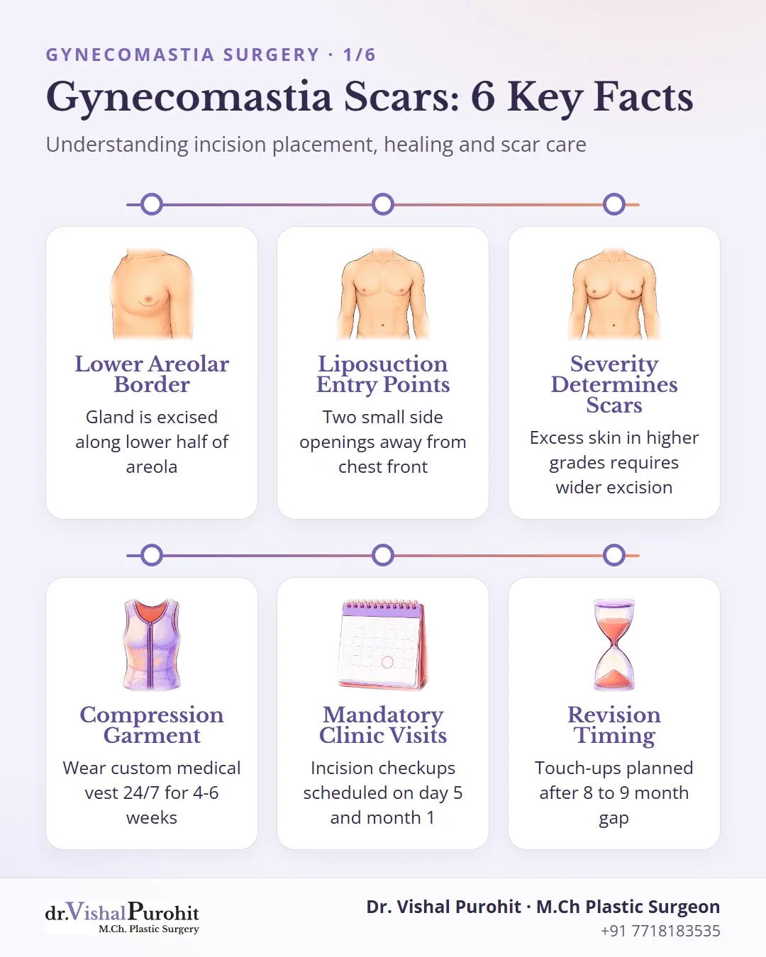 Summary infographic of gynecomastia surgical scars, incision locations, recovery vest and follow-up timeline.