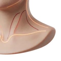 Clusters Along Neck & Underarms