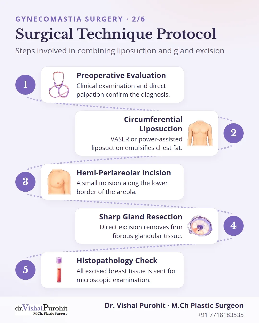 Five step surgical protocol combining examination, liposuction, incision, gland excision, and tissue pathology.
