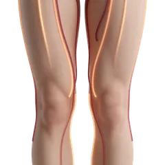 Painful Friction & Chafing