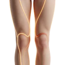 Groin Crease Anchoring