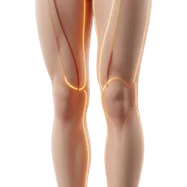 Lateral Thigh / Saddlebags