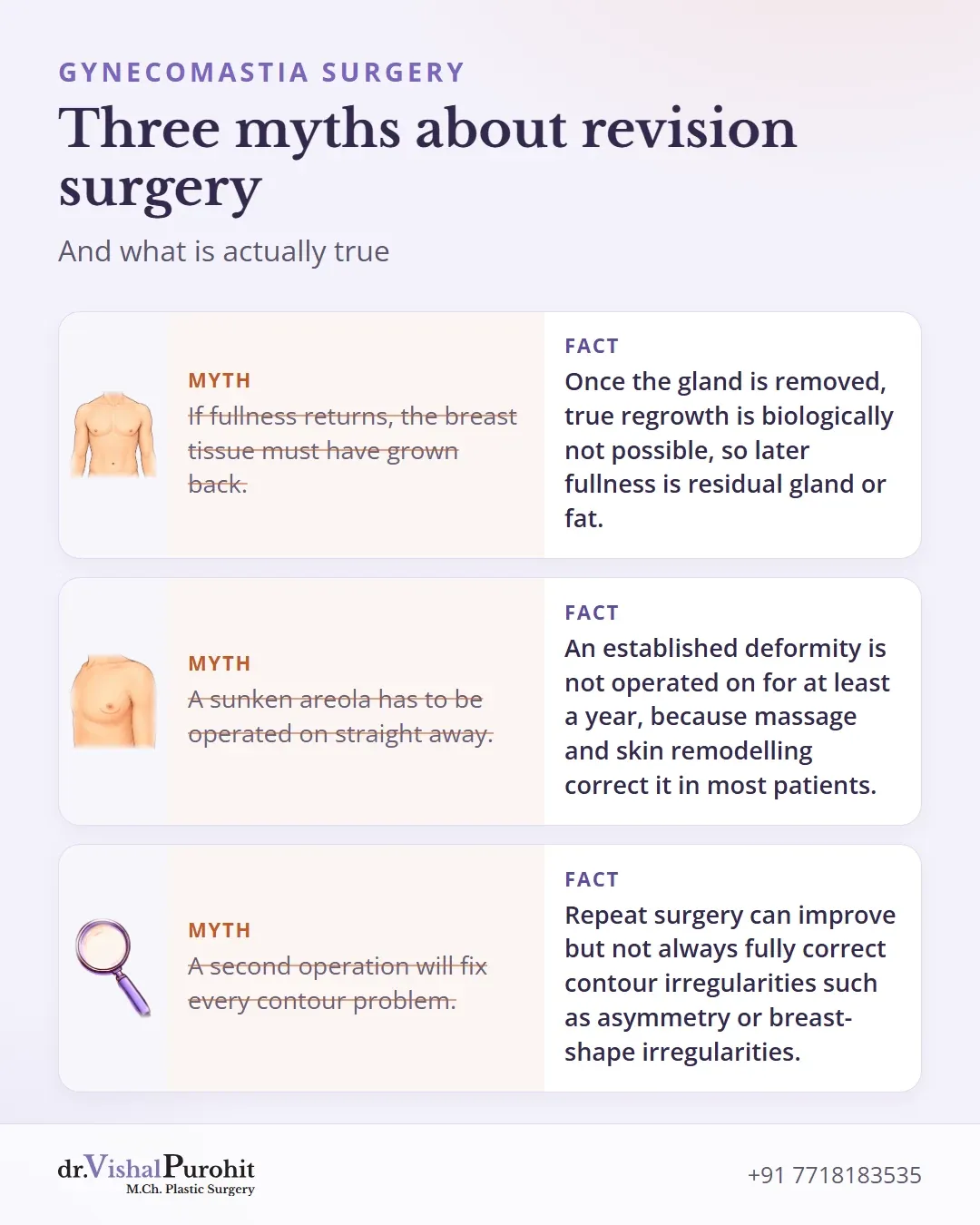 Three myths about revision surgery corrected with what the post states.