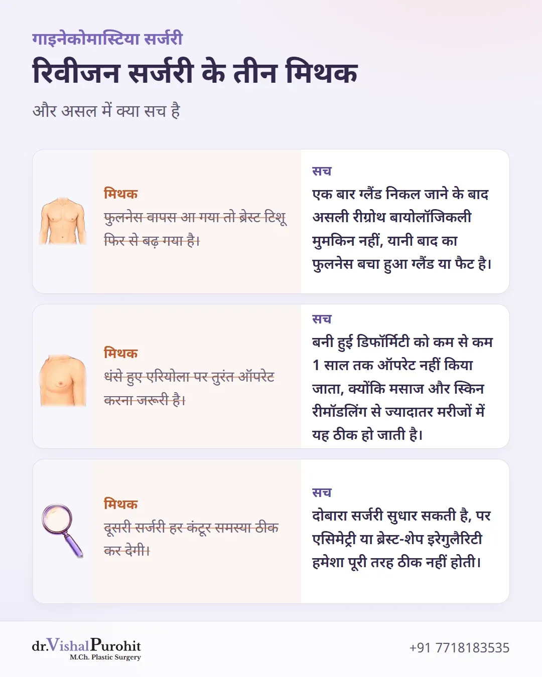 रिवीजन सर्जरी के तीन मिथक और पोस्ट में दी गई सच्चाई।