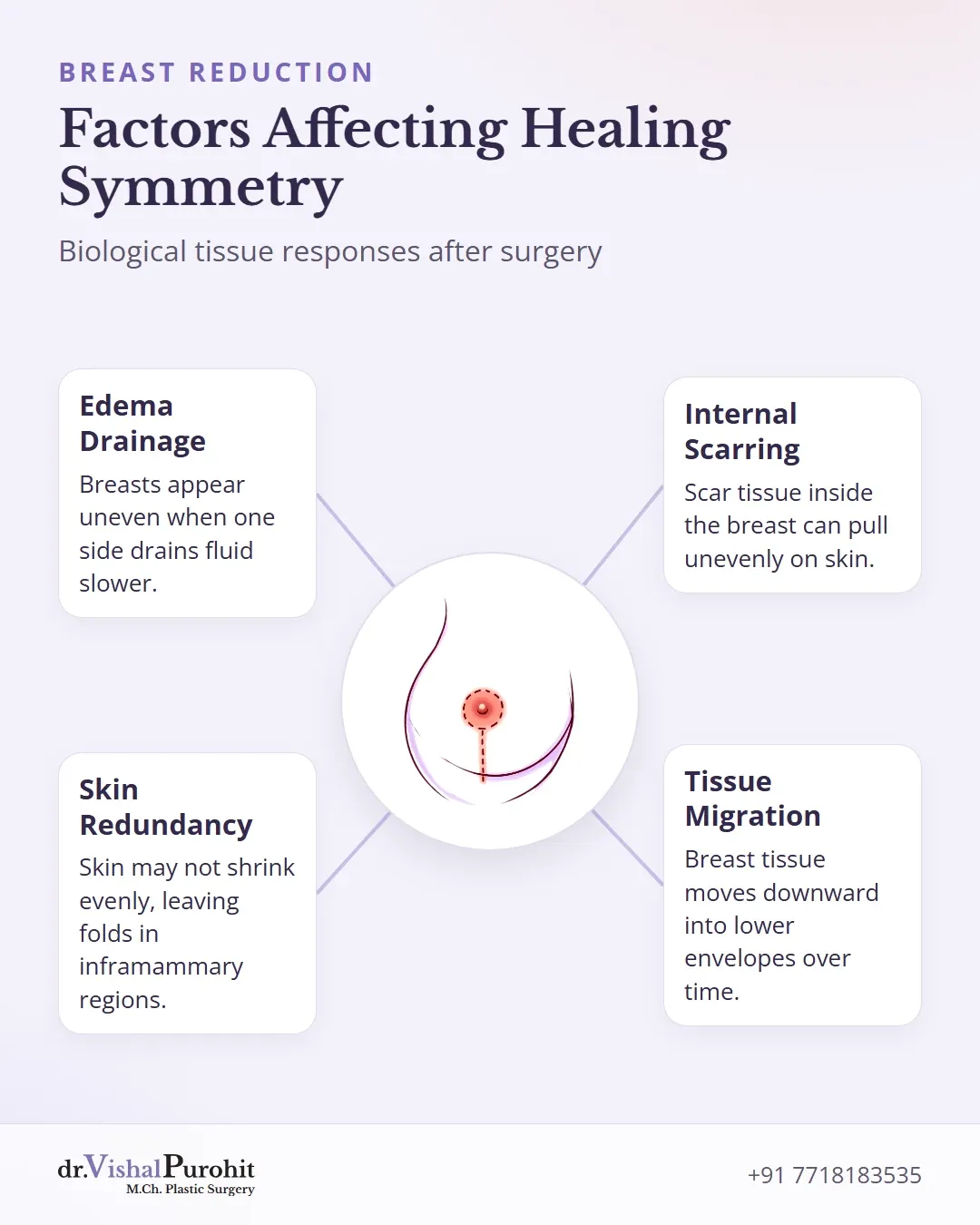 Diagram showing edema, skin redundancy, internal scarring, and tissue migration as causes of breast shape asymmetry.