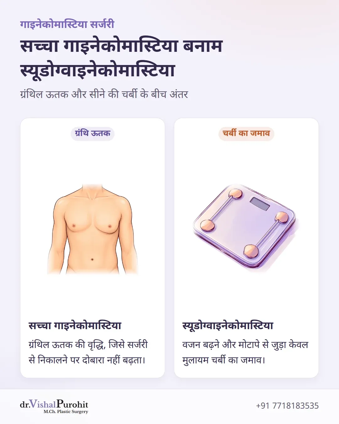 सच्चे ग्रंथिल गाइनेकोमास्टिया और मोटापे से जुड़े स्यूडोग्वाइनेकोमास्टिया की तुलना।