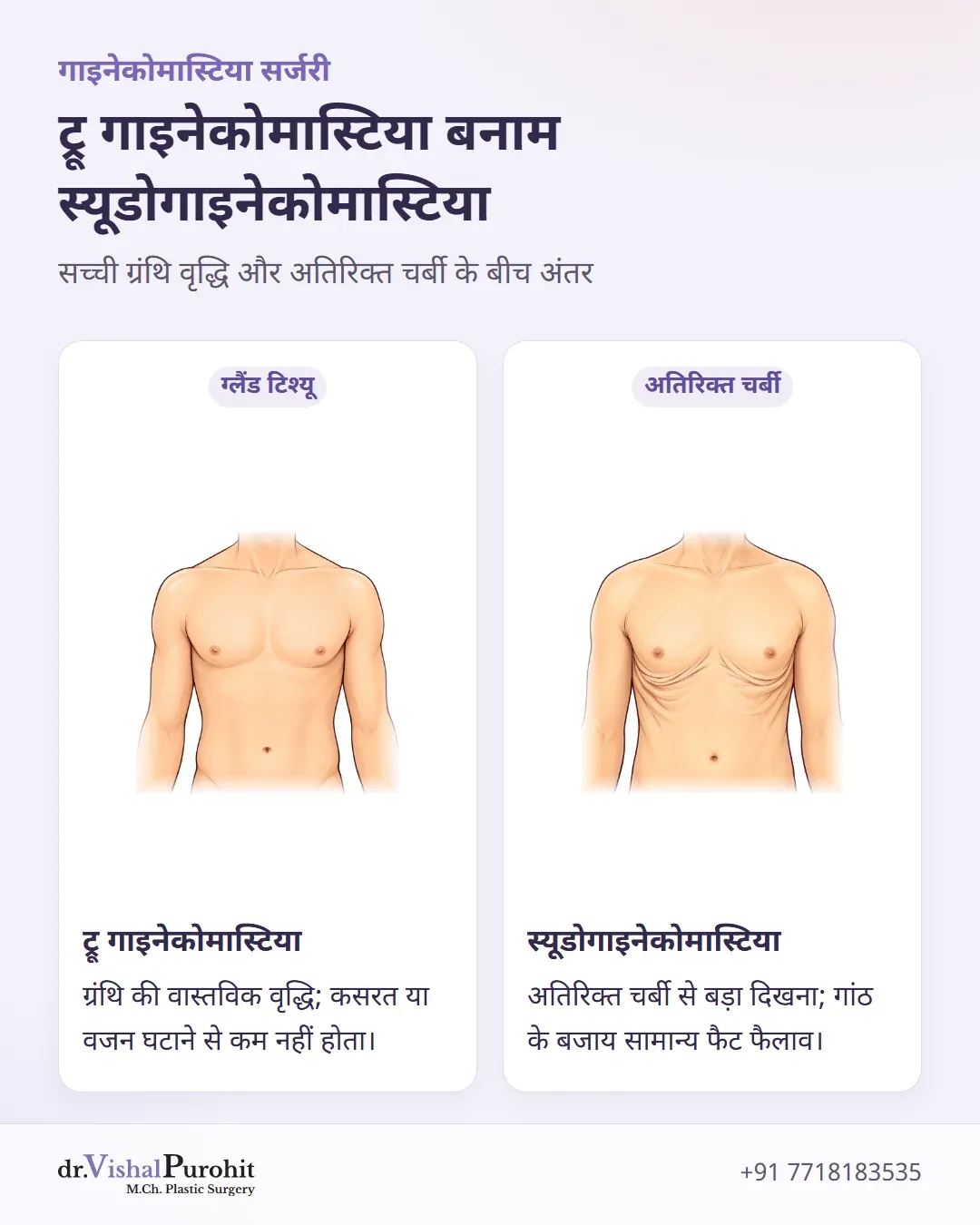 ट्रू गाइनेकोमास्टिया और स्यूडोगाइनेकोमास्टिया के बीच अंतर का तुलनात्मक इन्फोग्राफिक।