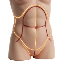 Rectus Muscle Plication