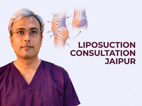 Liposuction Consultation in Jaipur: What to Expect