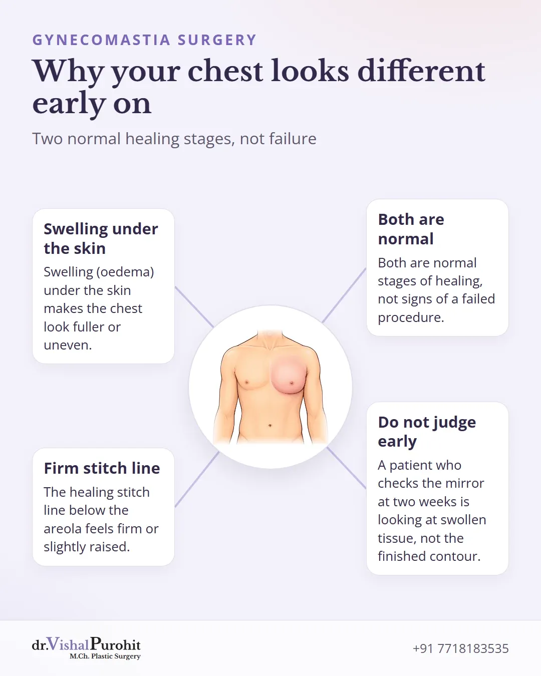 Explainer of swelling and a firm stitch line in early healing after surgery.