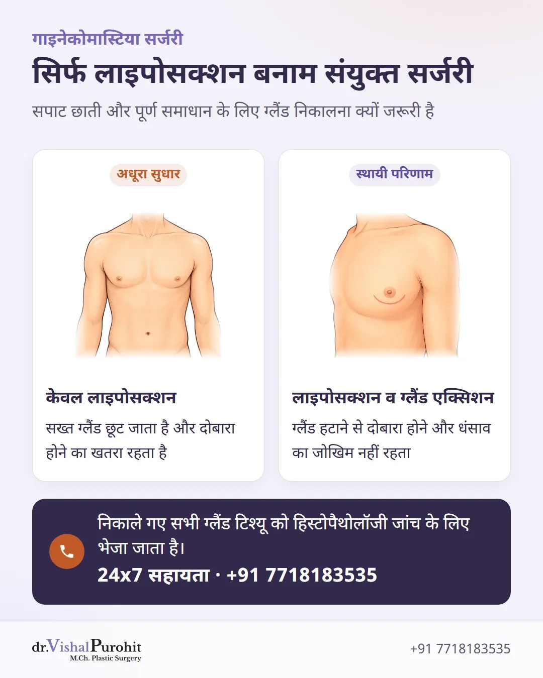 केवल लाइपोसक्शन और ग्लैंड एक्सिशन के साथ लाइपोसक्शन की तुलना।