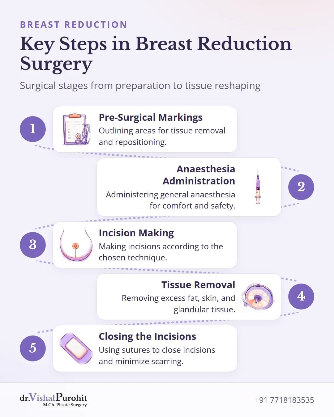 Flowchart showing key steps of breast reduction surgery from markings to wound closure.