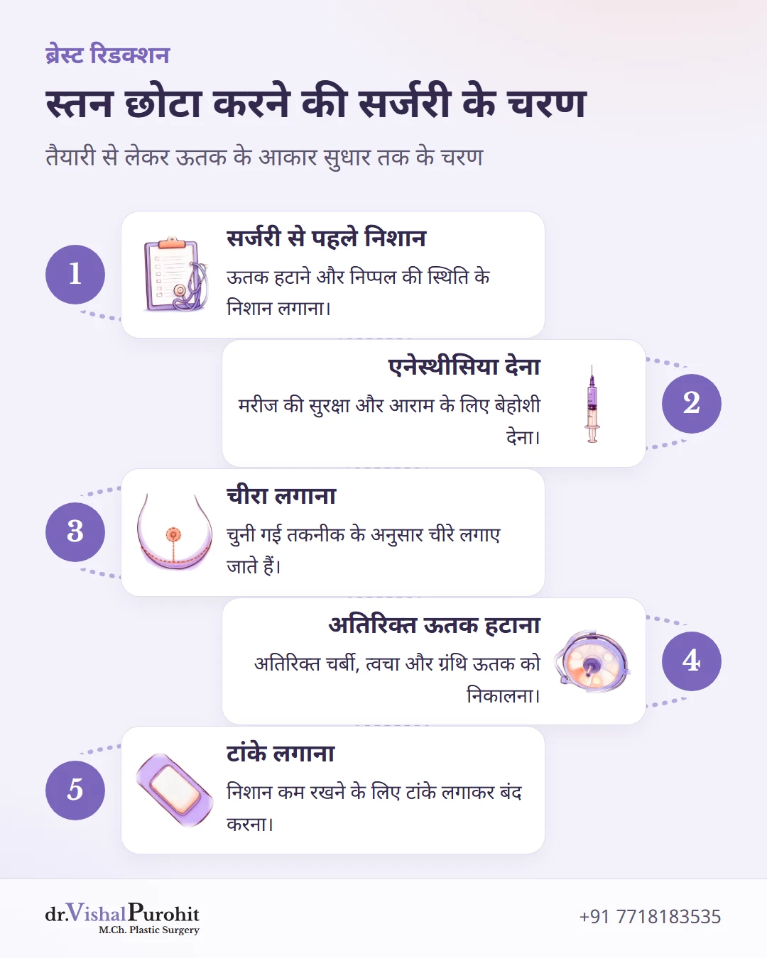 स्तन छोटा करने की सर्जरी के मुख्य चरणों को दर्शाता आरेख।