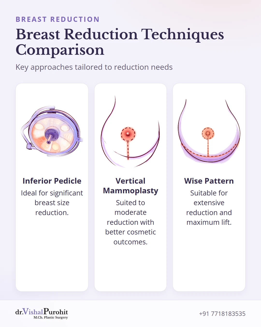 Comparison of traditional breast reduction techniques: inferior pedicle, vertical mammoplasty, and Wise pattern.