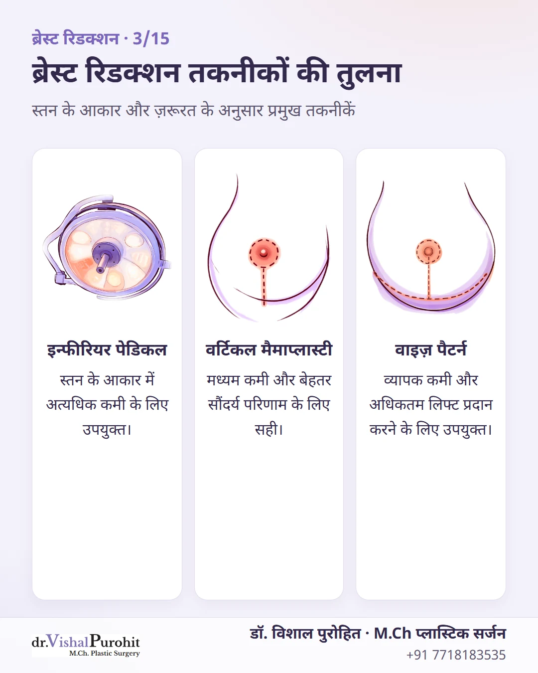 पारंपरिक ब्रेस्ट रिडक्शन तकनीकों की तुलना: इन्फीरियर पेडिकल, वर्टिकल मैमाप्लास्टी और वाइज़ पैटर्न।