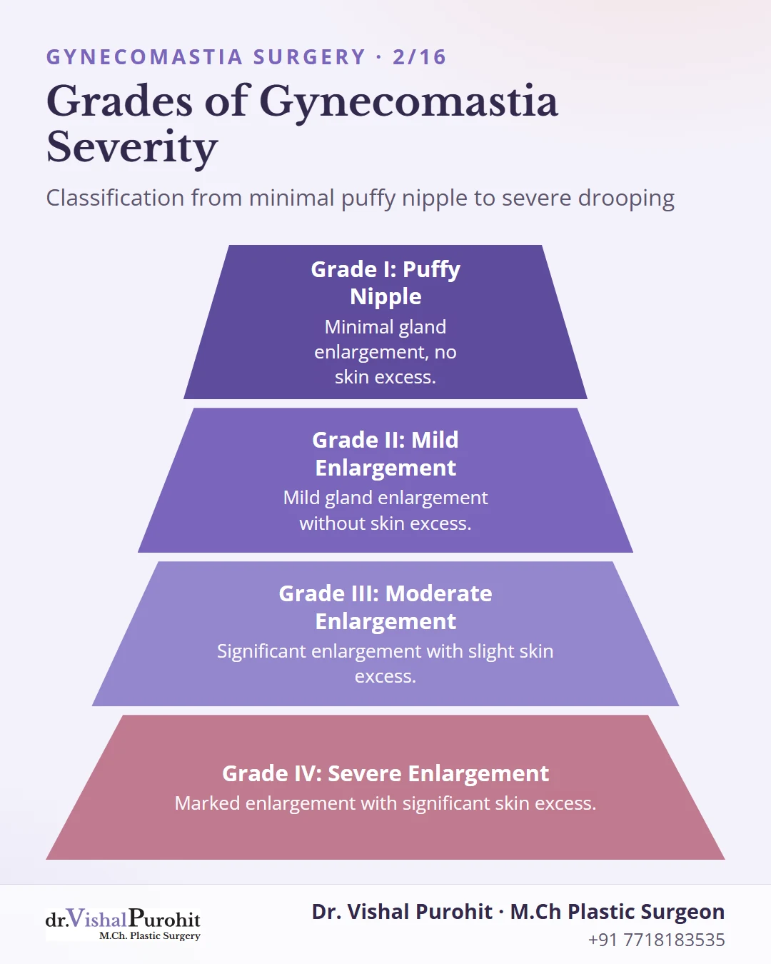 Pyramid chart showing the four grades of gynecomastia from Grade 1 to Grade 4.