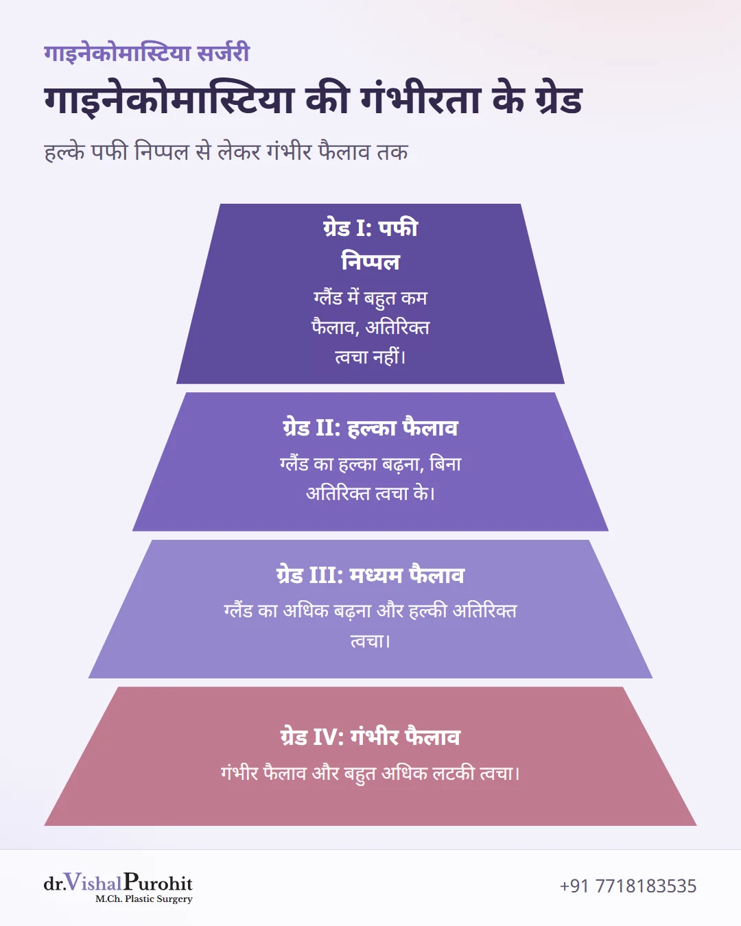 गाइनेकोमास्टिया के चार ग्रेड दर्शाने वाला पिरामिड चार्ट।