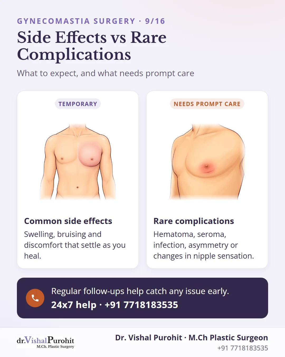 Comparison of temporary side effects and rare complications after gynecomastia surgery.