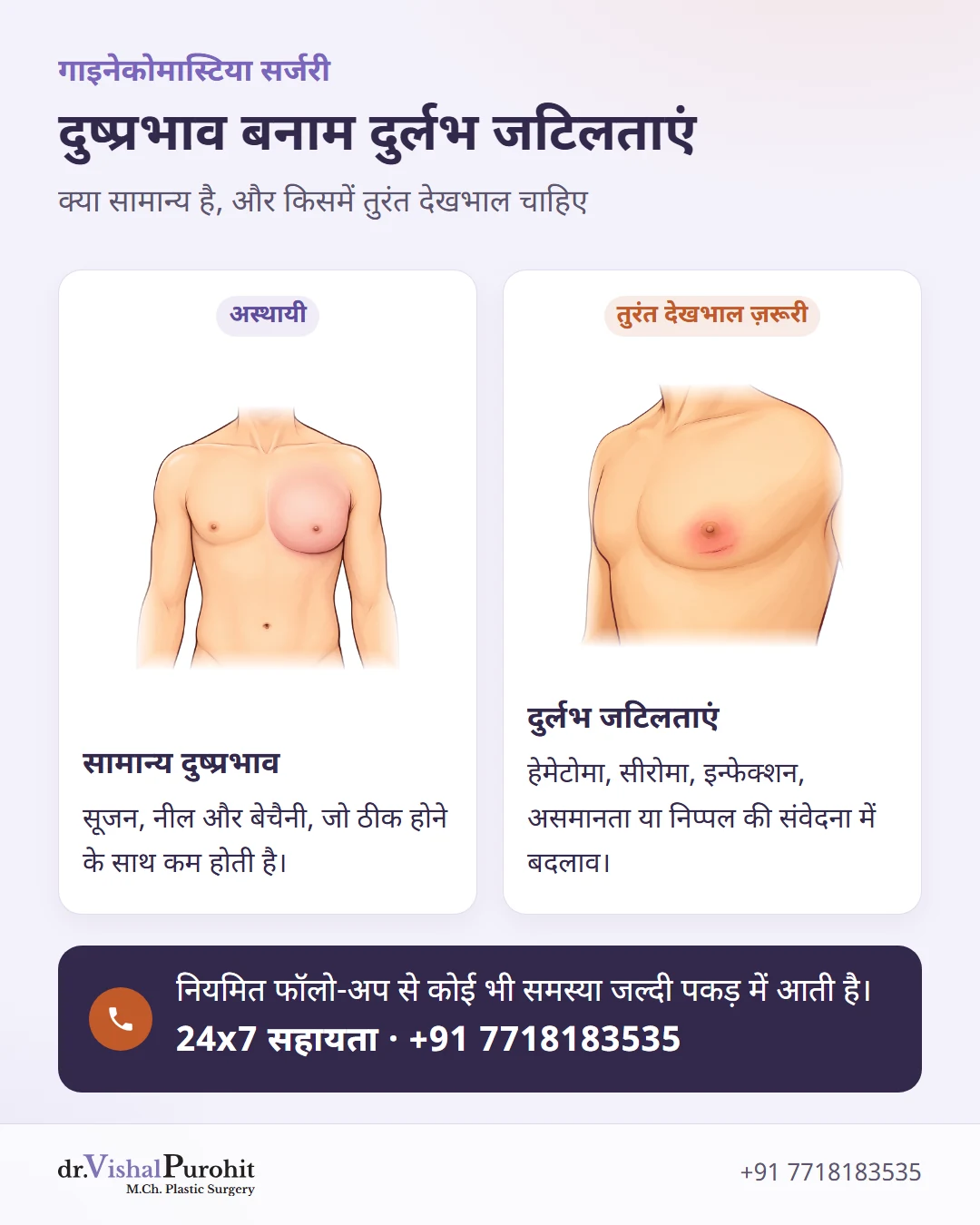 गाइनेकोमास्टिया सर्जरी के बाद अस्थायी दुष्प्रभाव और दुर्लभ जटिलताओं की तुलना।