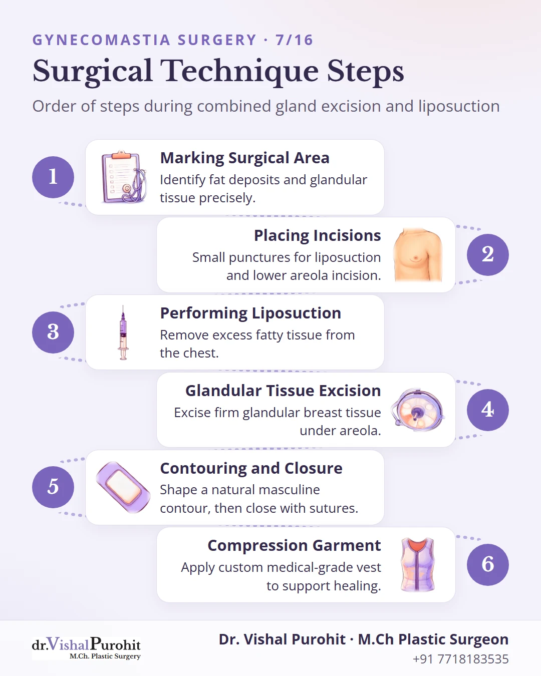 Process diagram showing the 6 surgical steps of gynecomastia correction.