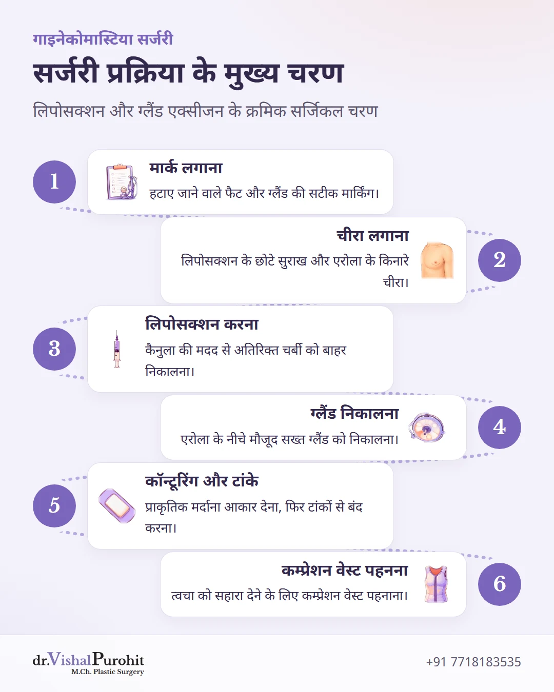 गाइनेकोमास्टिया सर्जरी के छह क्रमिक चरणों को दर्शाने वाला फ्लोचार्ट।