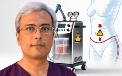 What Are the Main Risks of Liposuction Surgery?