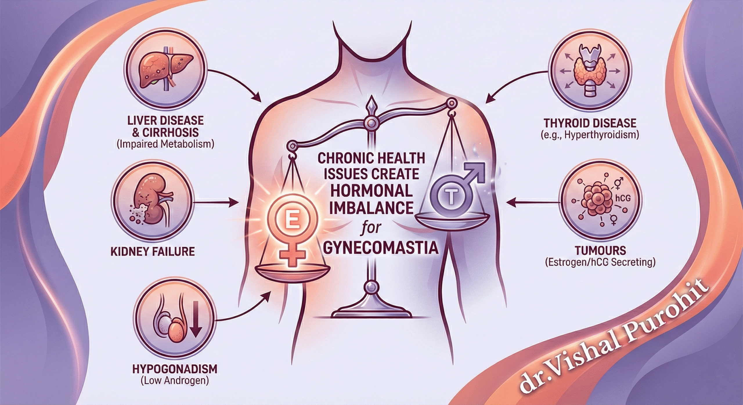 Medical infographic by dr. Vishal Purohit illustrating how chronic health issues create a hormonal imbalance, specifically an increase in estrogen over testosterone, which leads to gynecomastia. The image details causes like liver disease, kidney failure, hypogonadism, thyroid disease, and tumors.