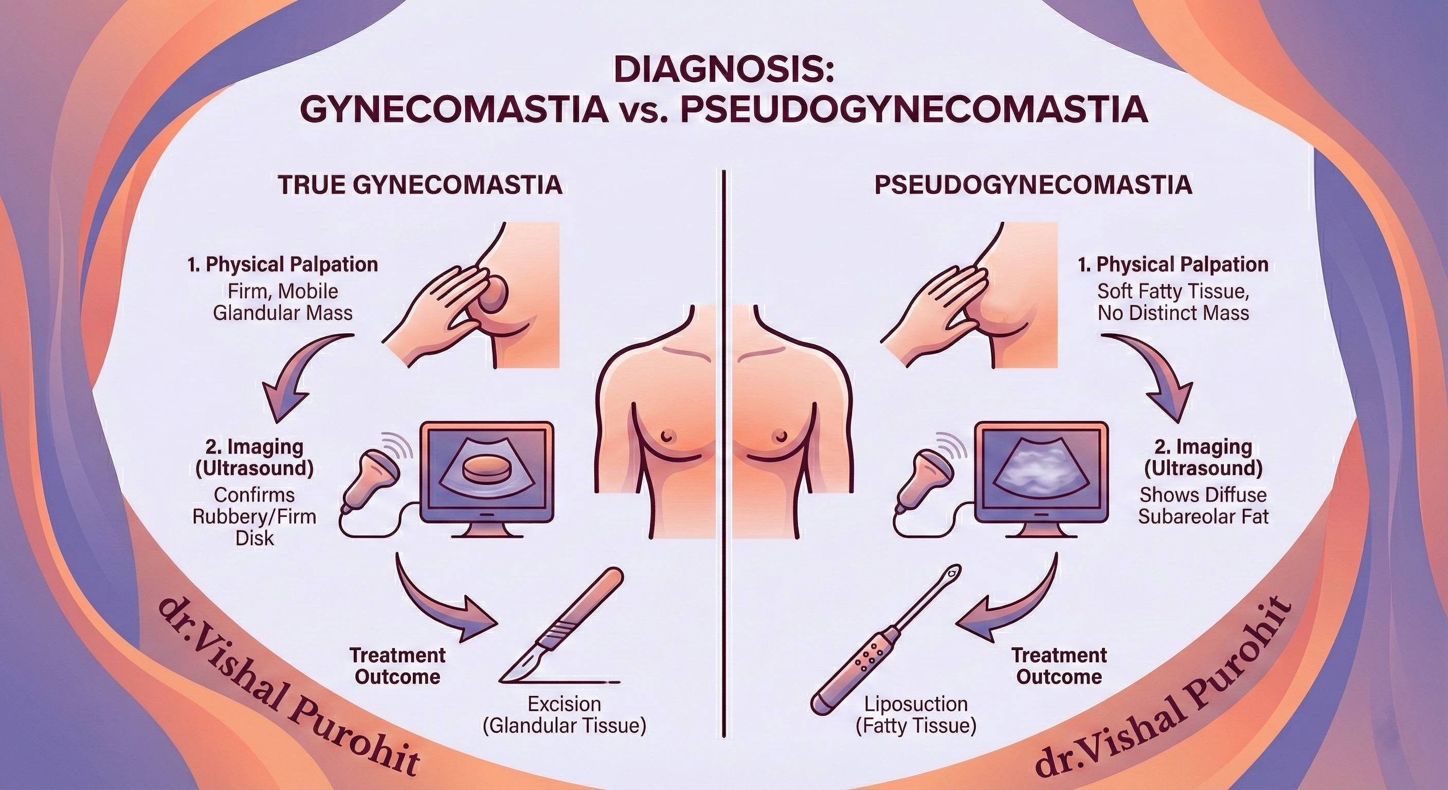 Infographic titled 'DIAGNOSIS: GYNECOMASTIA vs. PSEUDOGYNECOMASTIA' by dr.Vishal Purohit. It illustrates the diagnostic steps and treatment outcomes for True Gynecomastia (firm glandular mass, treated with excision) and Pseudogynecomastia (soft fatty tissue, treated with liposuction), including physical palpation and ultrasound imaging