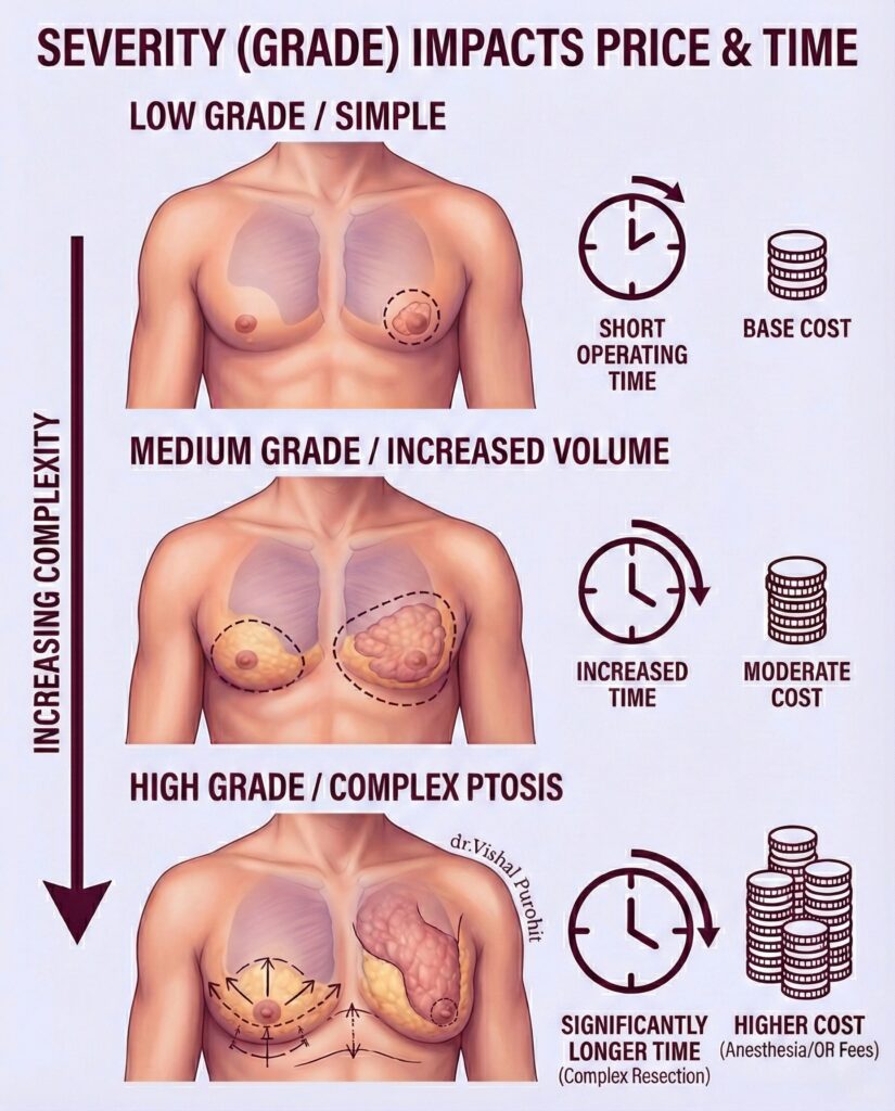 Infographic illustrating gynecomastia grades, surgical complexity, operating time, and associated costs.
