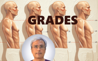 How Many Grades of Gynecomastia Exist?