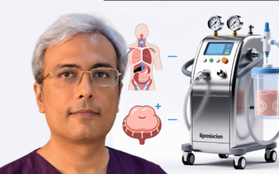 When Is Liposuction Medically Necessary in Jaipur?