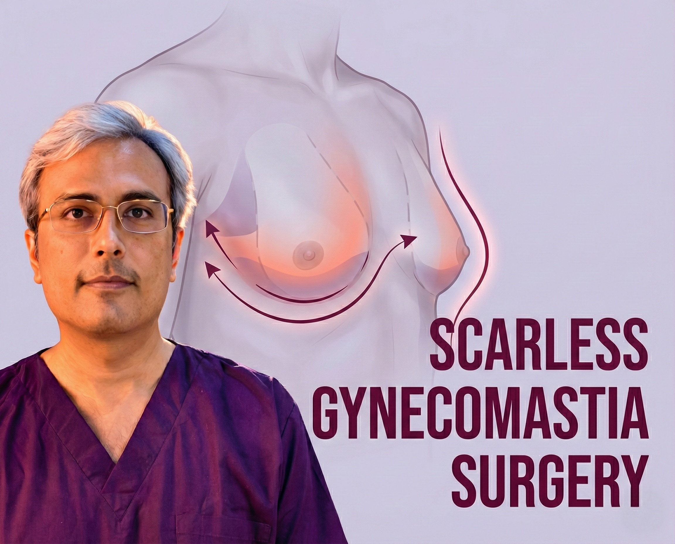 Gynecomastia Scars: Reality, Prevention & Management