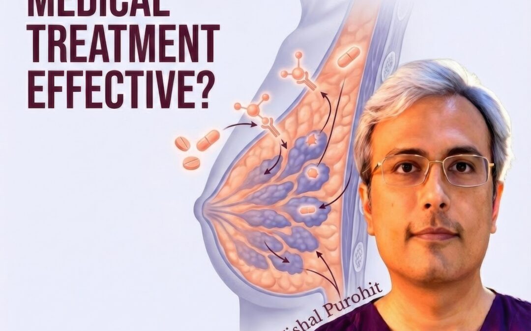 The Window of Opportunity: When is Medical Treatment Effective for Gynecomastia?