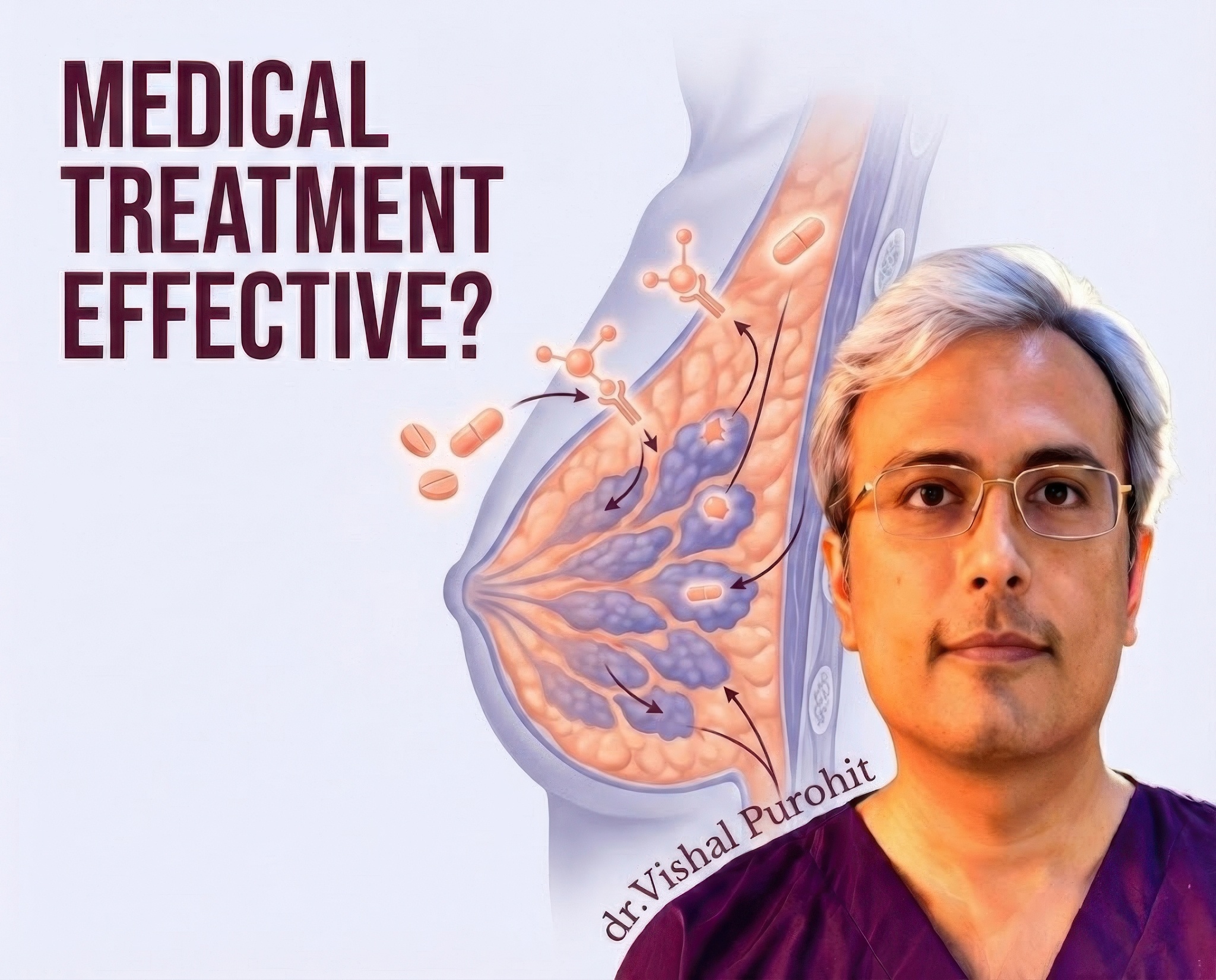 The Window of Opportunity: When is Medical Treatment Effective for Gynecomastia?