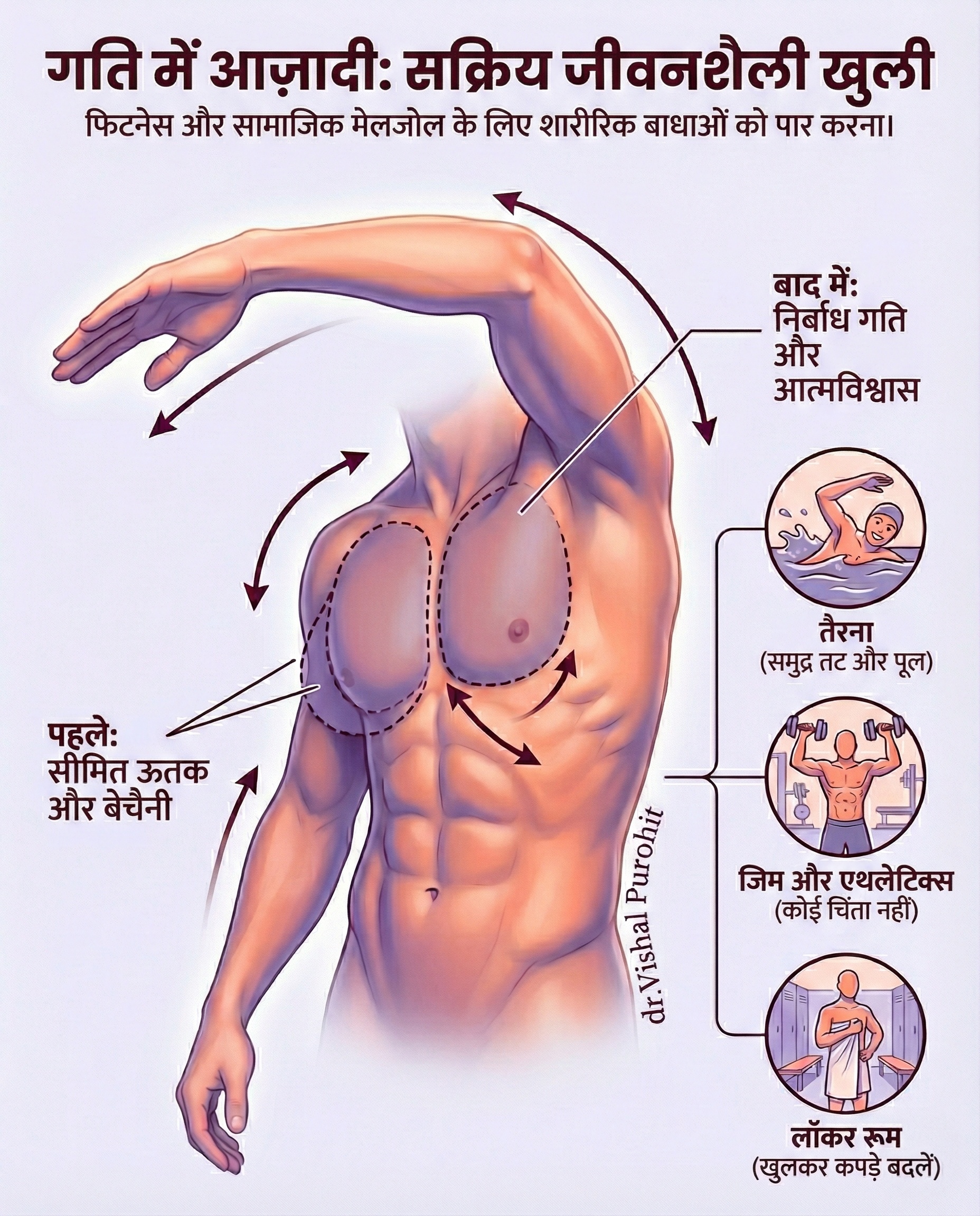 Male chest reduction infographic showing before and after results for gynecomastia, emphasizing free movement.