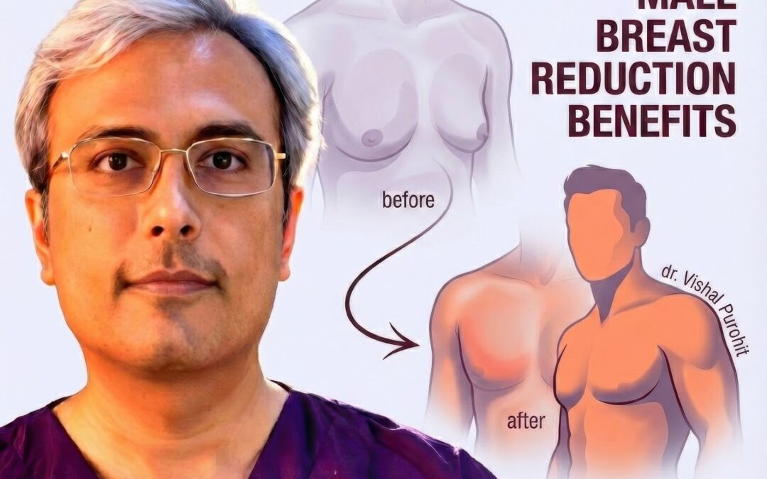 Benefits of Gynecomastia Surgery: Physical & Psychological Transformation