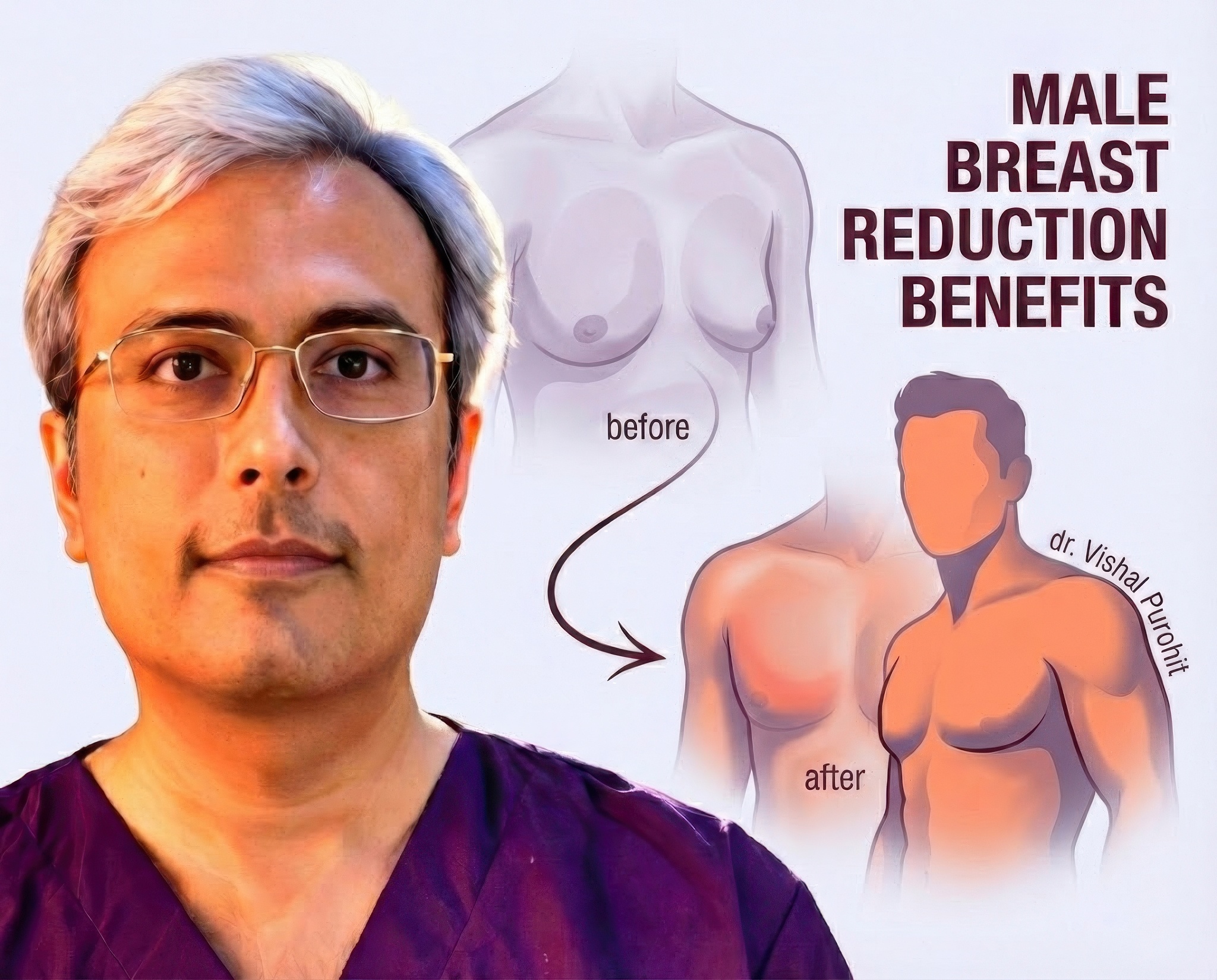 Benefits of Gynecomastia Surgery: Physical & Psychological Transformation