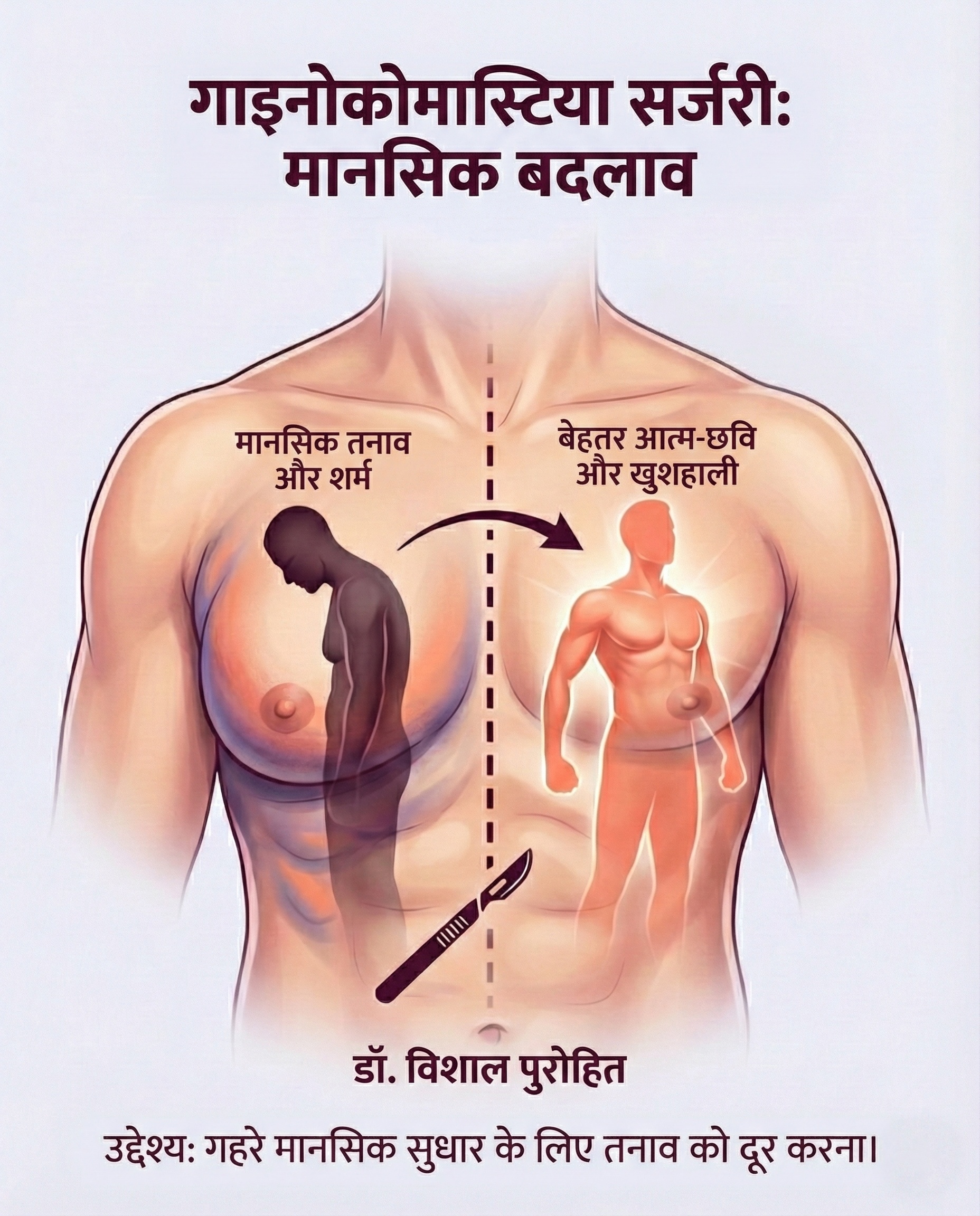 Gynecomastia surgery infographic illustrating before and after results and psychological benefits.